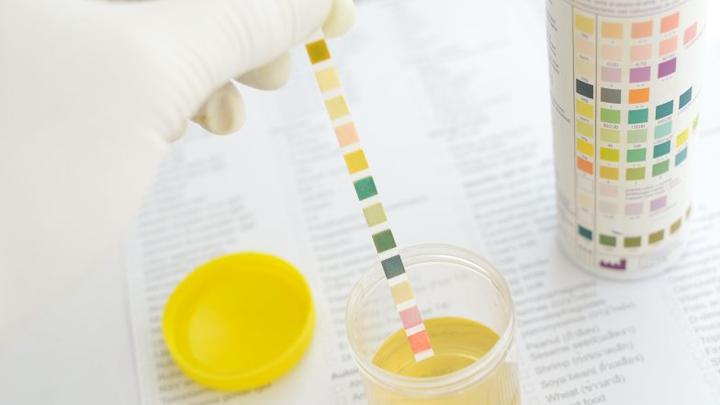 Kiedy białko w moczu po porodzie staje się powodem do niepokoju?