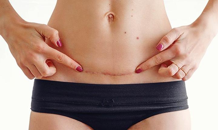 Dieta wspierająca gojenie blizn