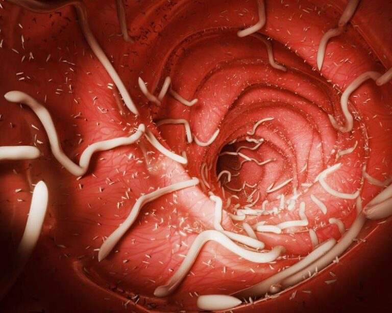 Jak skutecznie pozbyć się glisty ludzkiej u dzieci? Sprawdzone metody i porady