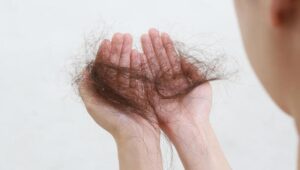 Jak skutecznie zaradzić wypadaniu włosów po ciąży? Porady i sprawdzone metody