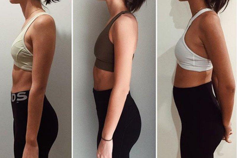 Tyłozgięcie macicy