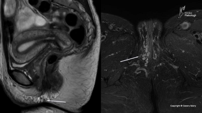Domowe sposoby na ulgę
