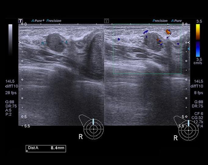 Przygotowanie do badania USG