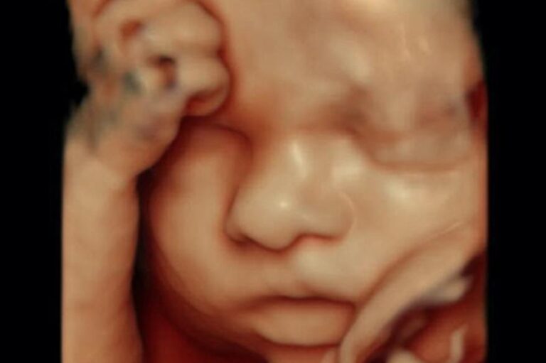 Czy badania prenatalne mogą ujawnić płeć dziecka? Oto, co musisz wiedzieć