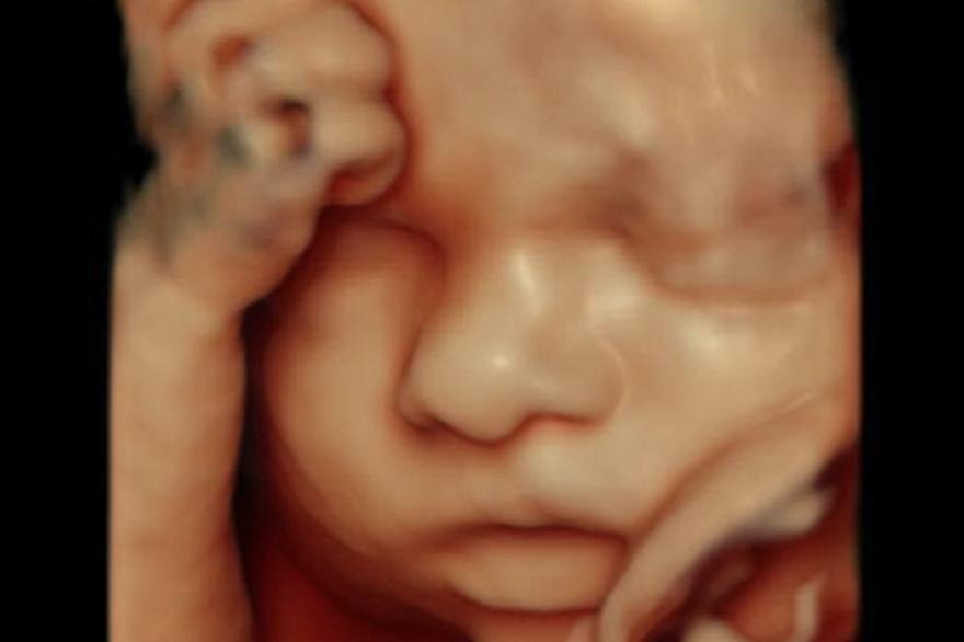 Czy badania prenatalne mogą ujawnić płeć dziecka? Oto, co musisz wiedzieć